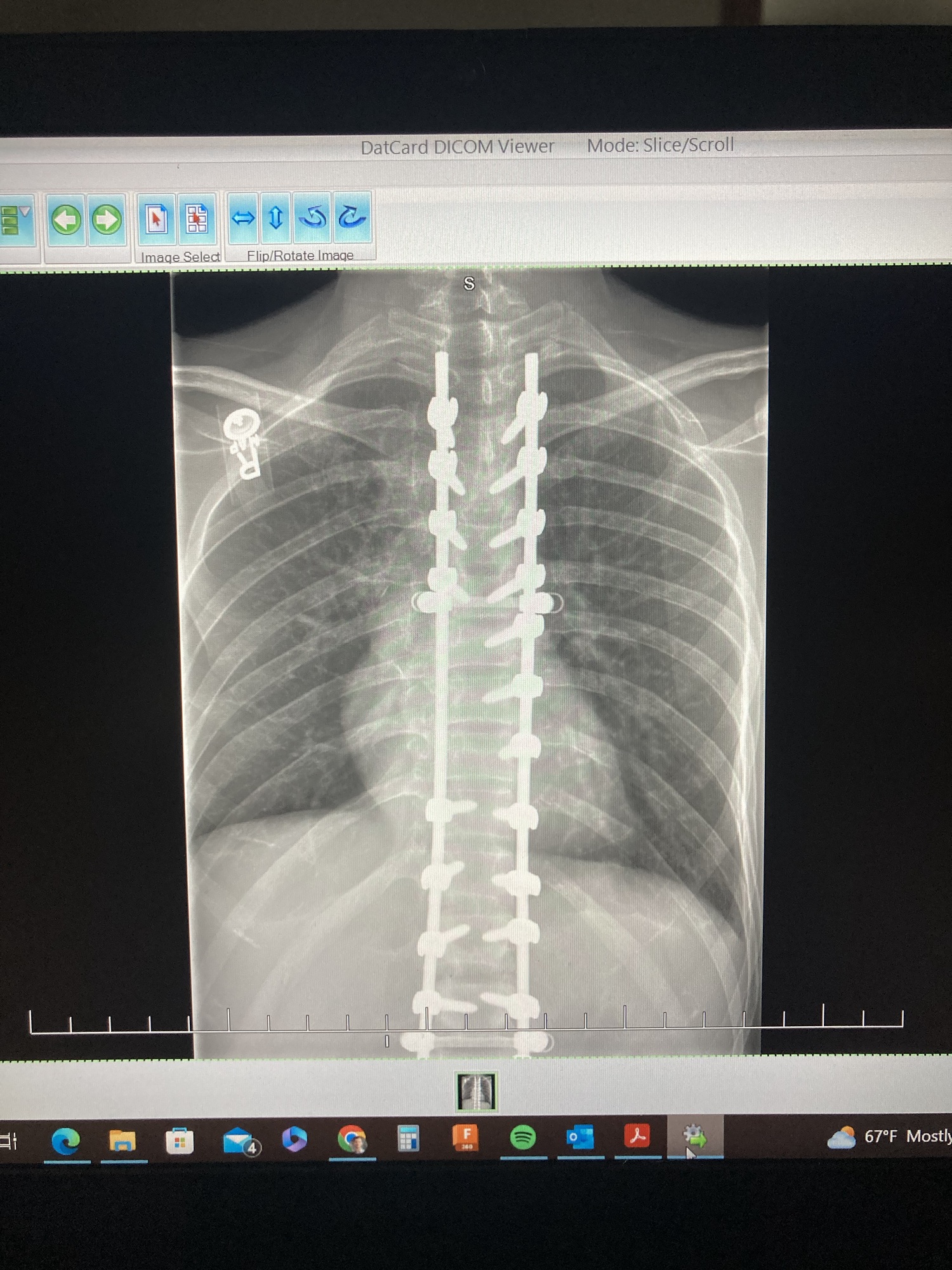 September 19th 2023 – Metal&nbsp;Rods