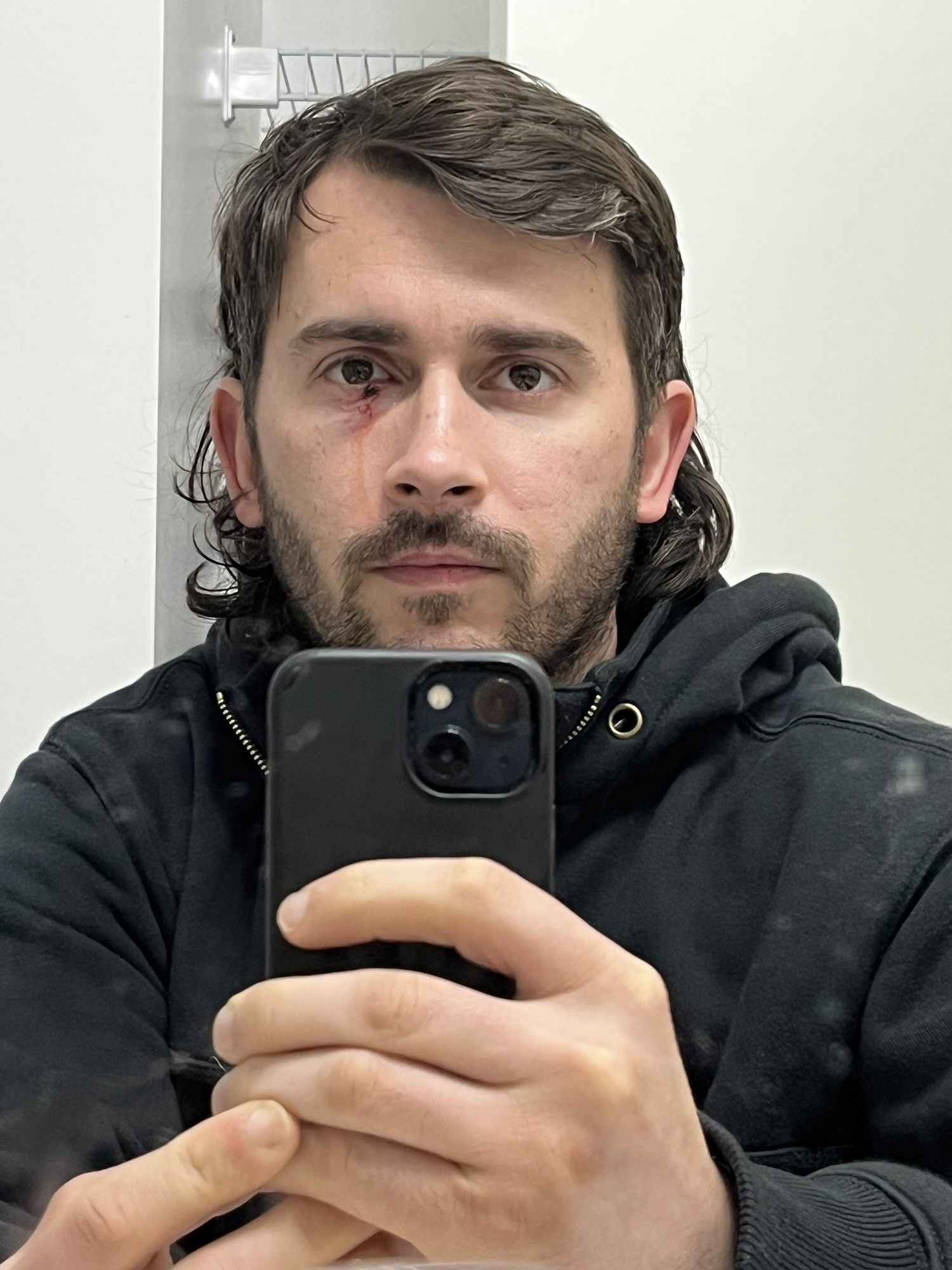 Active Motor Learning and The Observer Effect for SCI Rehab – “Murder in the City”| Feb 16 – 22&nbsp;2025