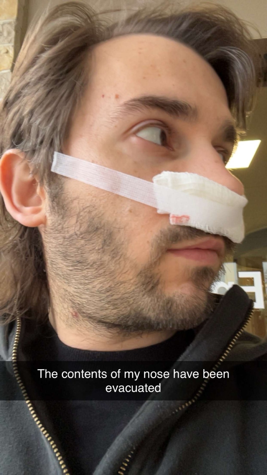 Quad Sets + Sinus Surgery for fueling SCI Recovery | Apr 13 – 19&nbsp;2025