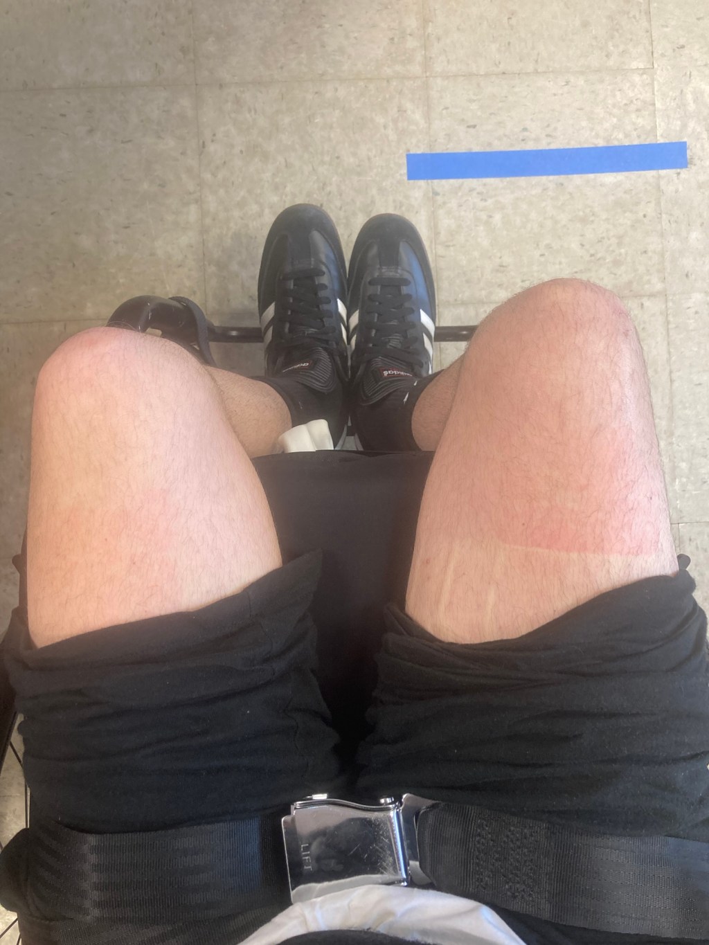 Blood Flow Restriction (BFR) Therapy for SCI Rehab | Aug 20 – 26&nbsp;2023